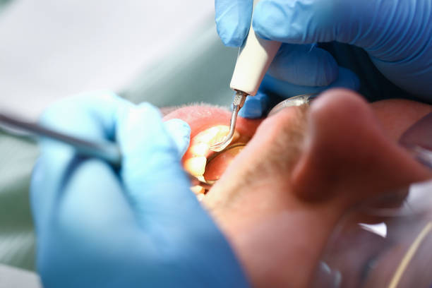 Best Emergency Root Canal Treatment in Kaufman, TX