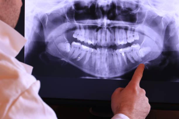 Best Emergency TMJ Treatment in Kaufman, TX